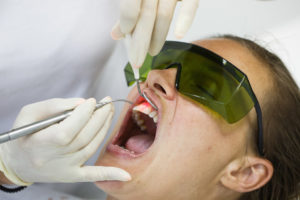 curare la parodontite