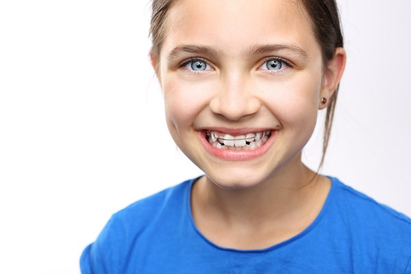 apparecchio ortodontico bambini