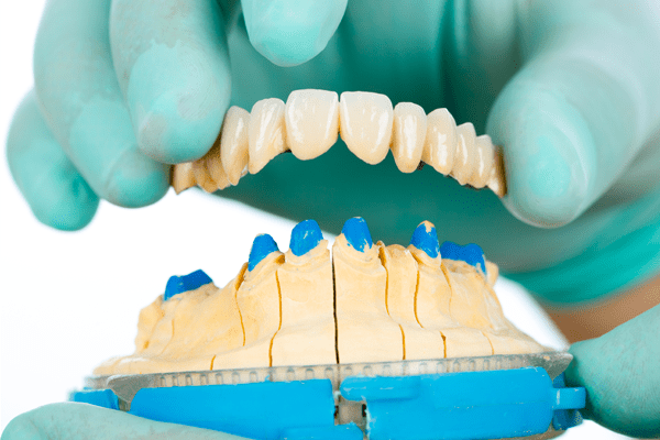 Denti finti in farmacia - Come trovarli e le accortezze