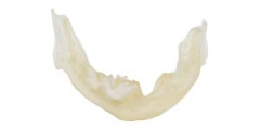 Replica 3D Eaglegrid | La nuova implantologia dentale universale